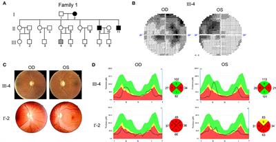 Multi-mtDNA Variants May Be a Factor Contributing to Mitochondrial Function Variety in the Skin-Derived Fibroblasts of Leber's Hereditary Optic Neuropathy Patients